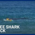 Shark MAULS Woman – Ocean Turns Red! Shark Attack At Coogee Beach Leaves Swimmer Fighting For Life | 10 News