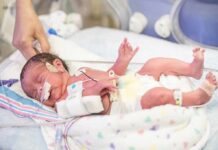NICU Horror Night Raises Chilling Questions Premature newborn in NICU with monitoring tubes